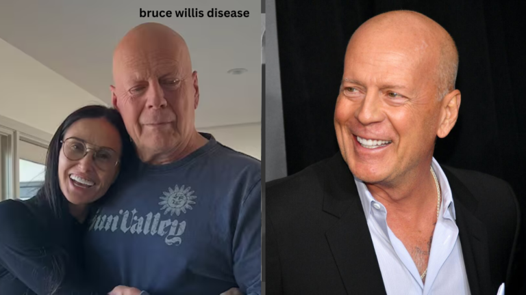 Bruce Willis Disease