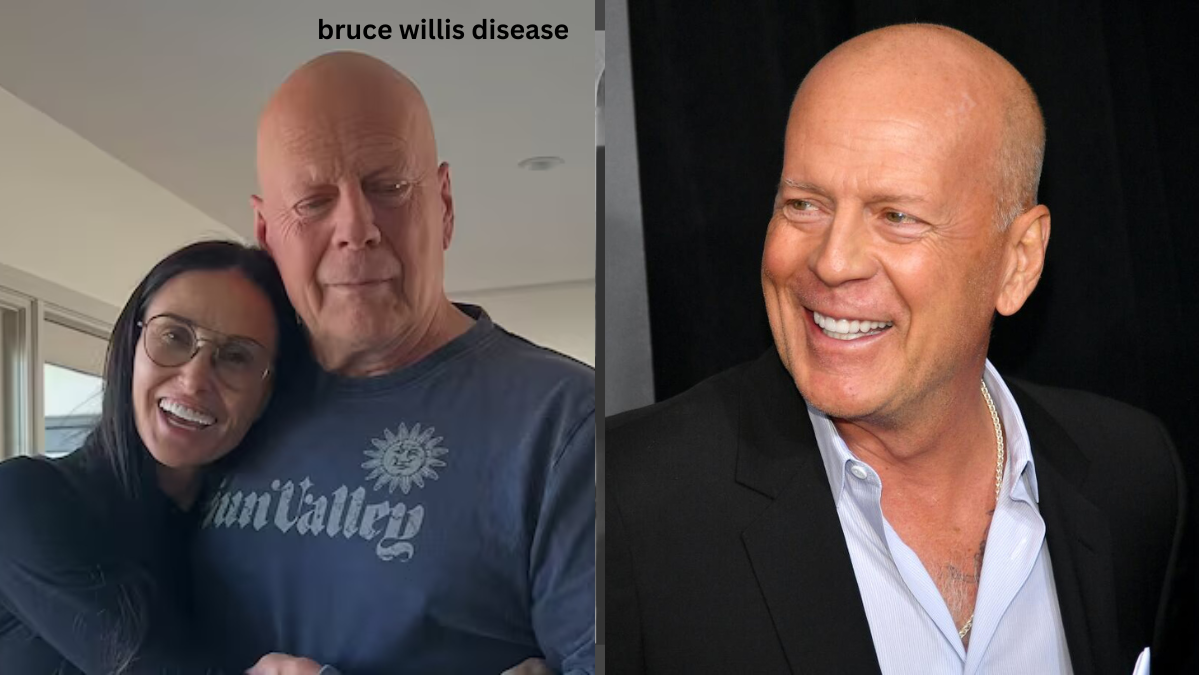 Bruce Willis Disease